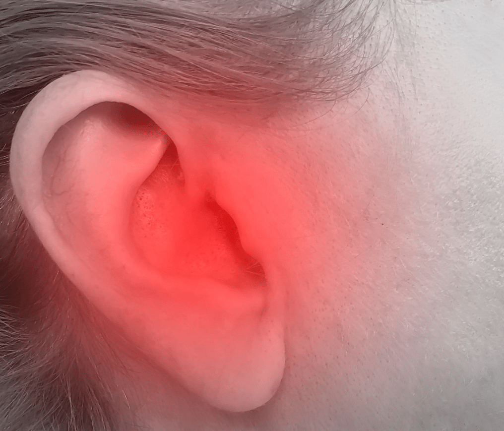 Swollen Ear Lobe Causes, Piercing, Abscess, Infection & Treatment