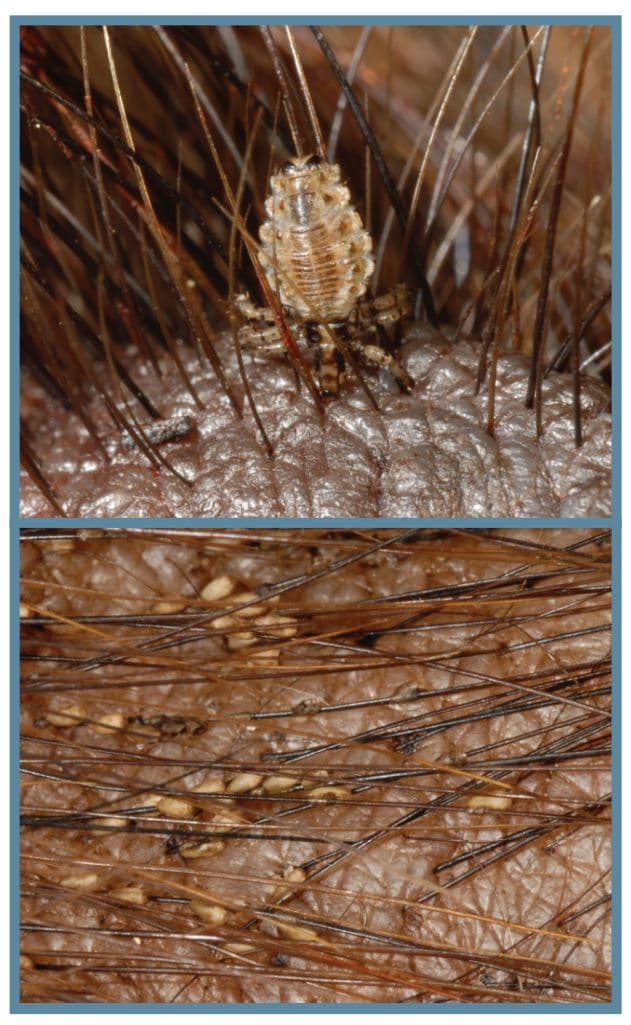 Identifying Swine Lice, Ticks, and Fleas