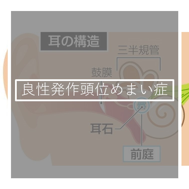 良性発作性頭位めまい症 あみはりきゅう整骨院グループ