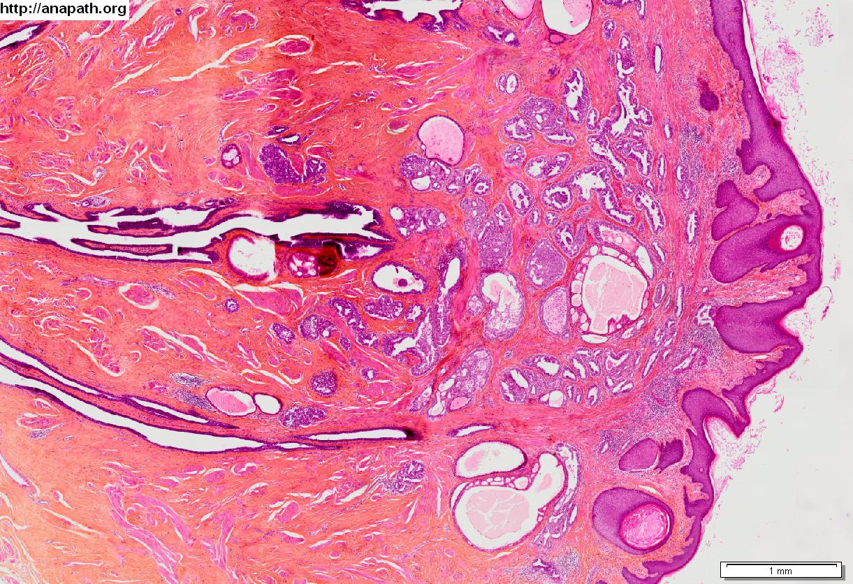 Atlas pathologie du sein