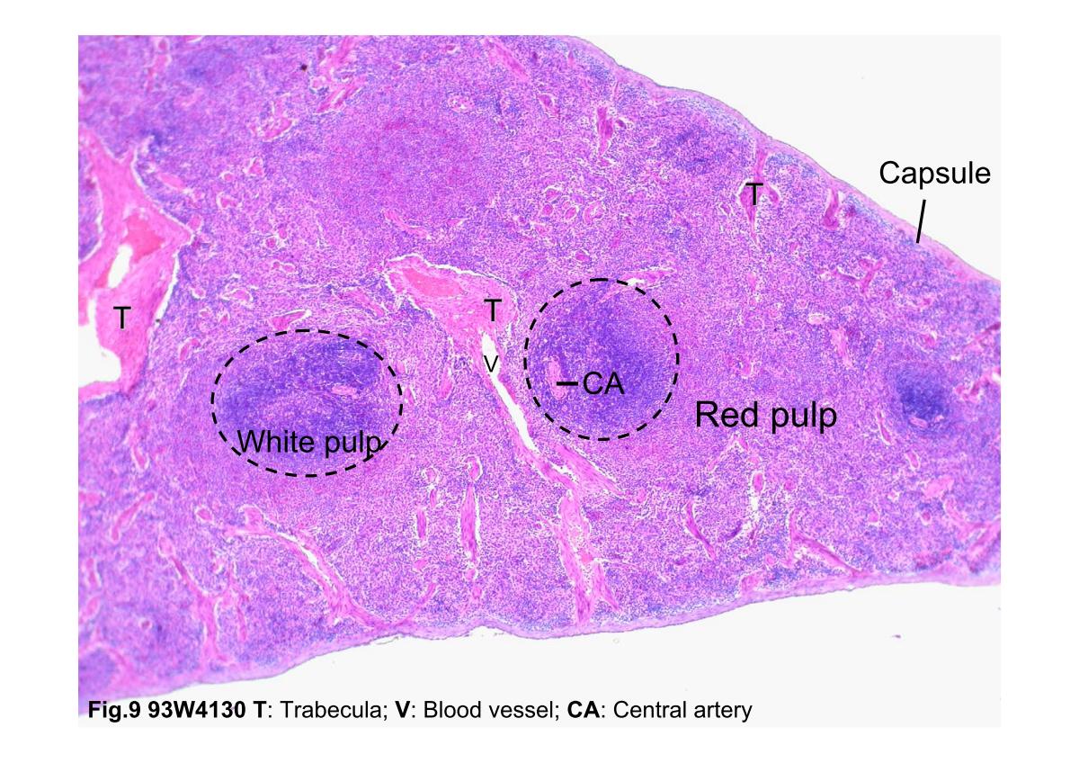 Block2/Fig.9 93W4130 Spleen, H&E.