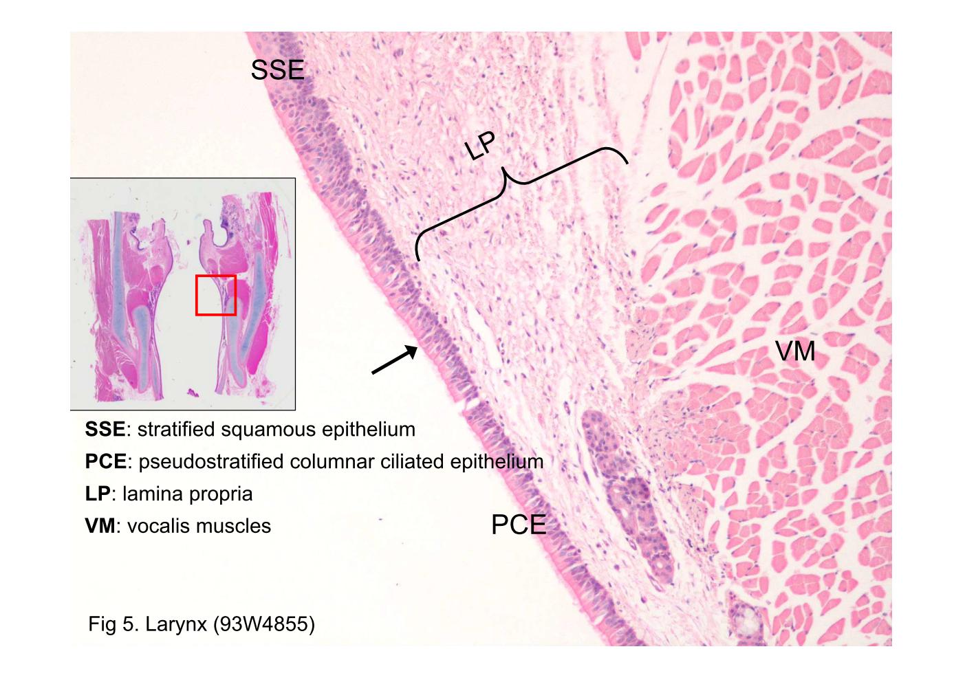 Block4/Fig 5. Larynx (93W4855)