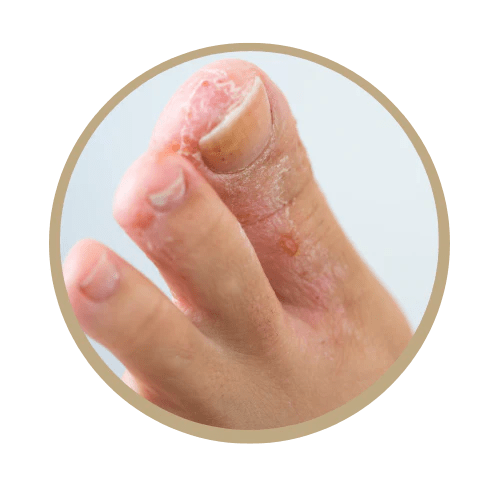 Ancaster Foot Fixer & Orthotics Clinic Ancaster Foot Fixer and