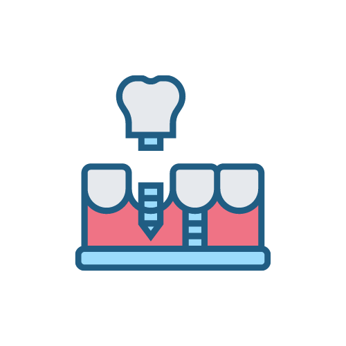 Post and Core Dental Post Andent Dental Laboratory