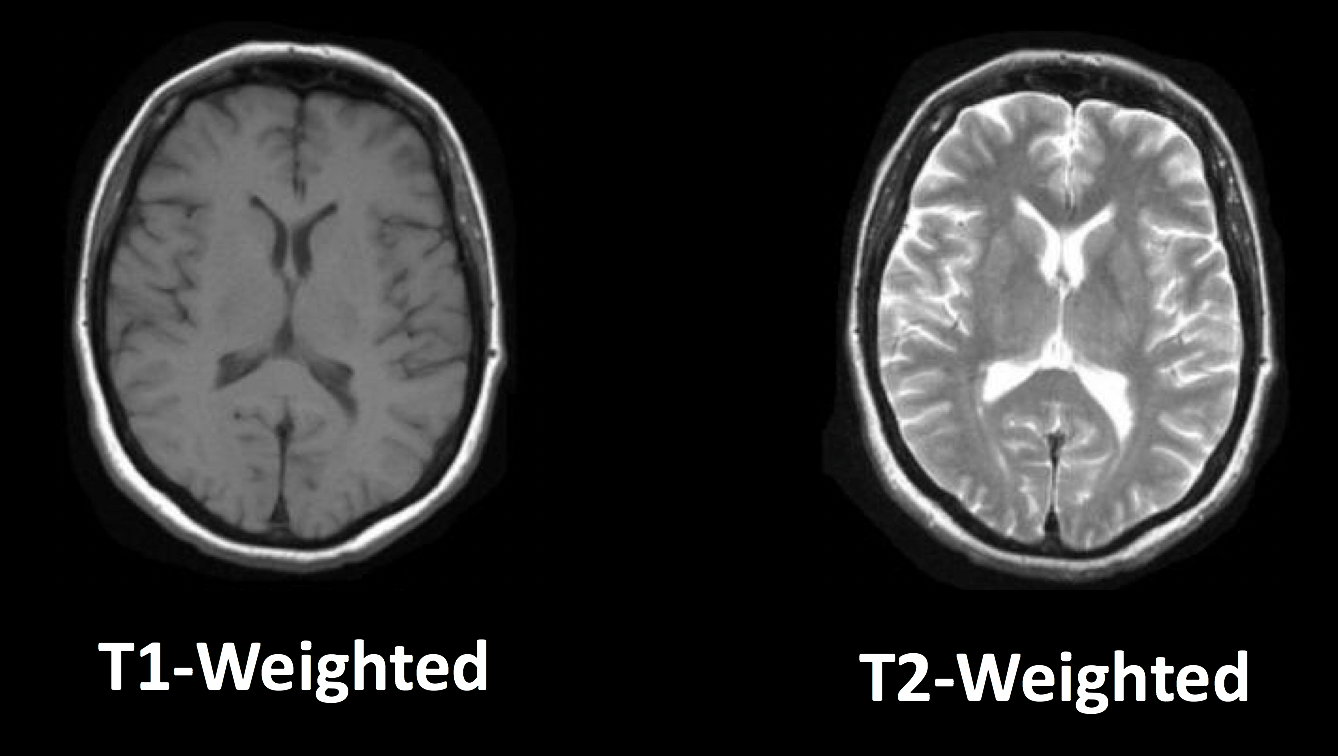 MRtrix Introduction Overview of Diffusion Imaging — Andy's Brain Book