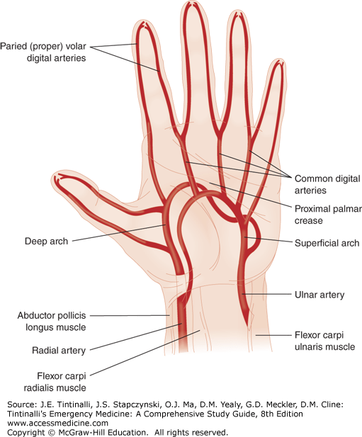 Injuries to the Hand and Digits Anesthesia Key