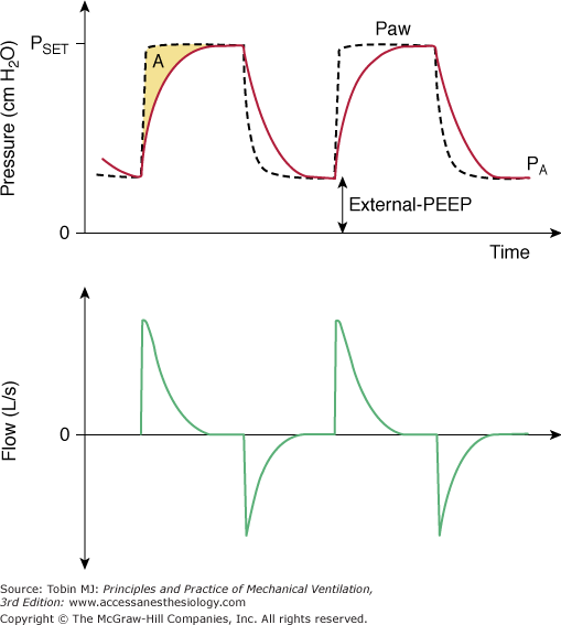 PressureControlled and InverseRatio Ventilation Anesthesia Key