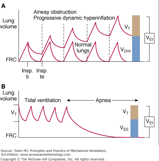 Mechanical Ventilation for Severe Asthma Anesthesia Key