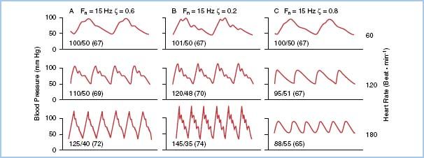 Monitoring the Cardiac Surgical Patient Anesthesia Key