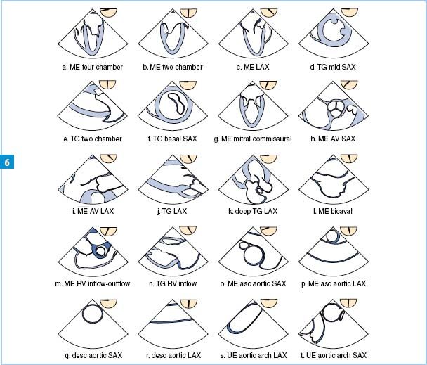 Transesophageal Echocardiography Anesthesia Key