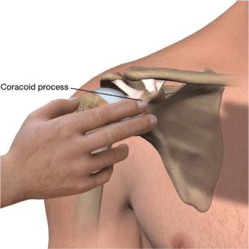 Joint and Associated Bursa Injections Shoulders, Elbows, Hips, and