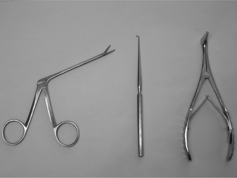 Nasal Foreign Body Removal Anesthesia Key