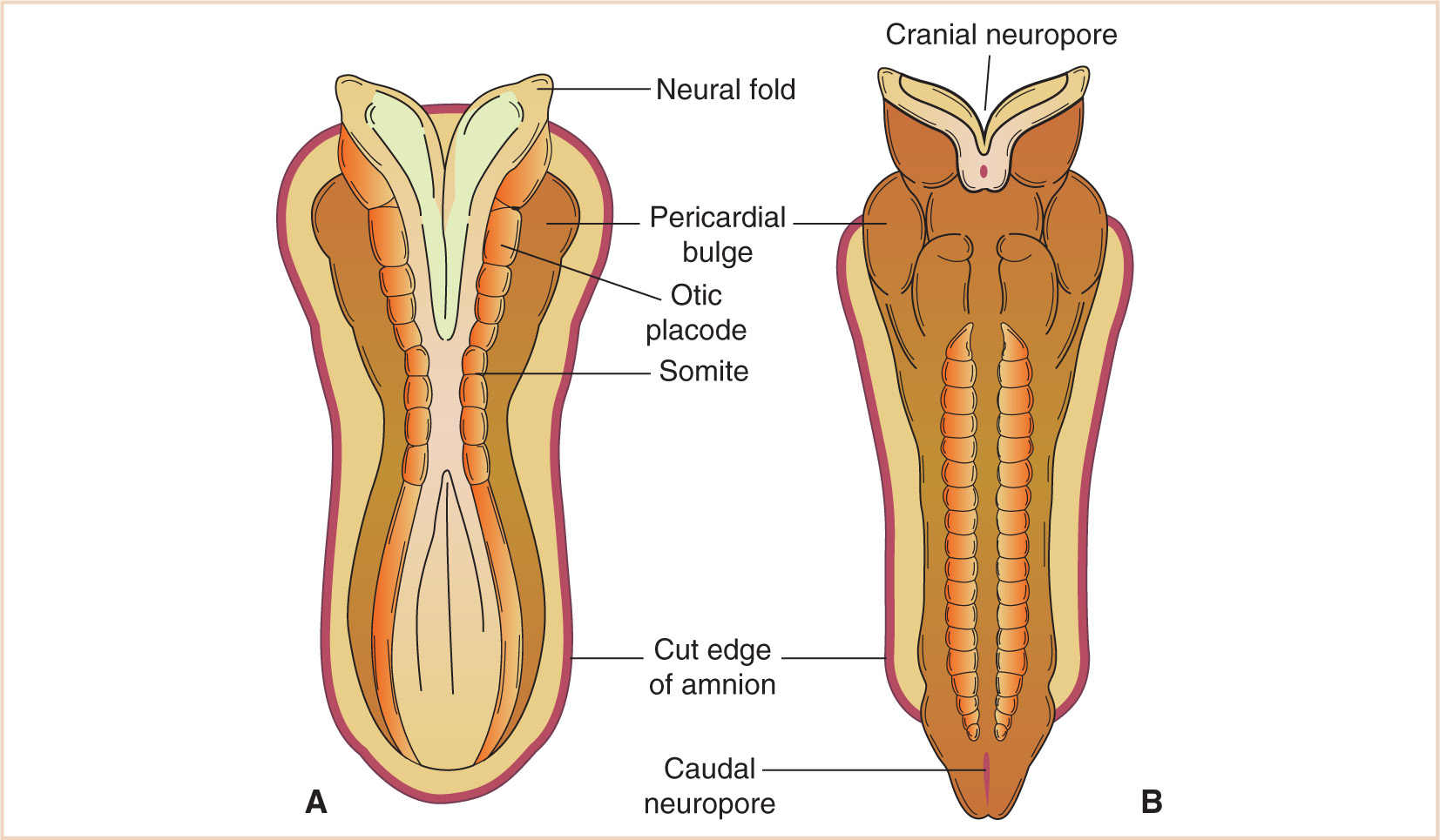 The Central Nervous System Pediatric Neuroanesthesia Anesthesia Key