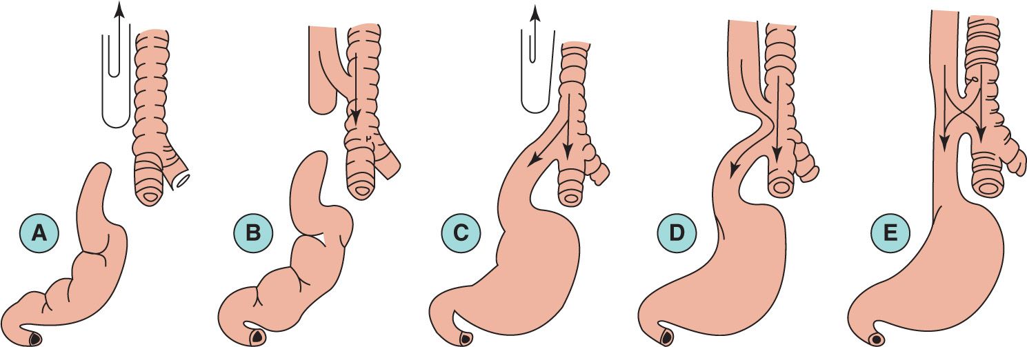 Pediatric Anesthesia Anesthesia Key