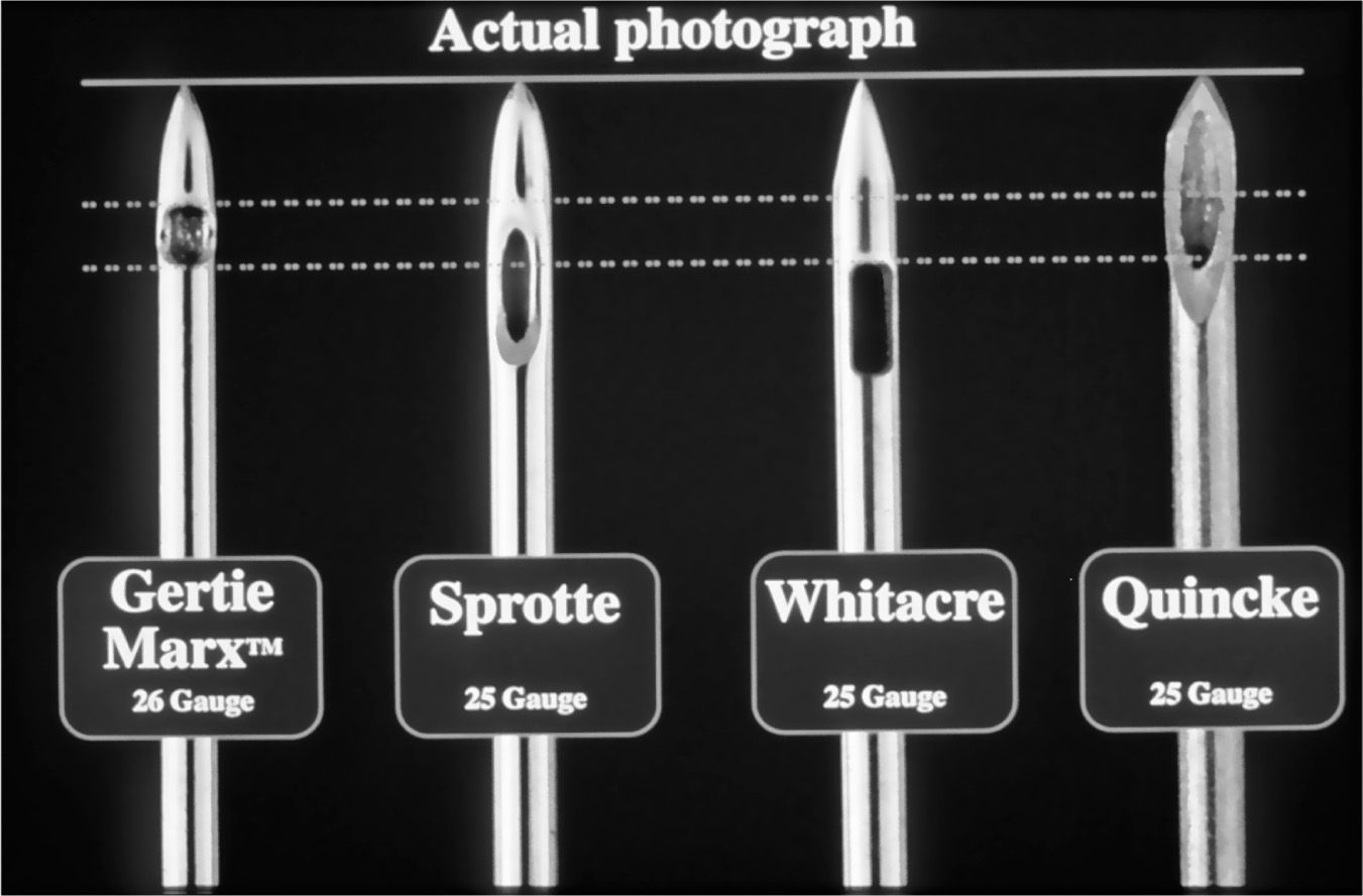 Postdural Puncture Headache Anesthesia Key