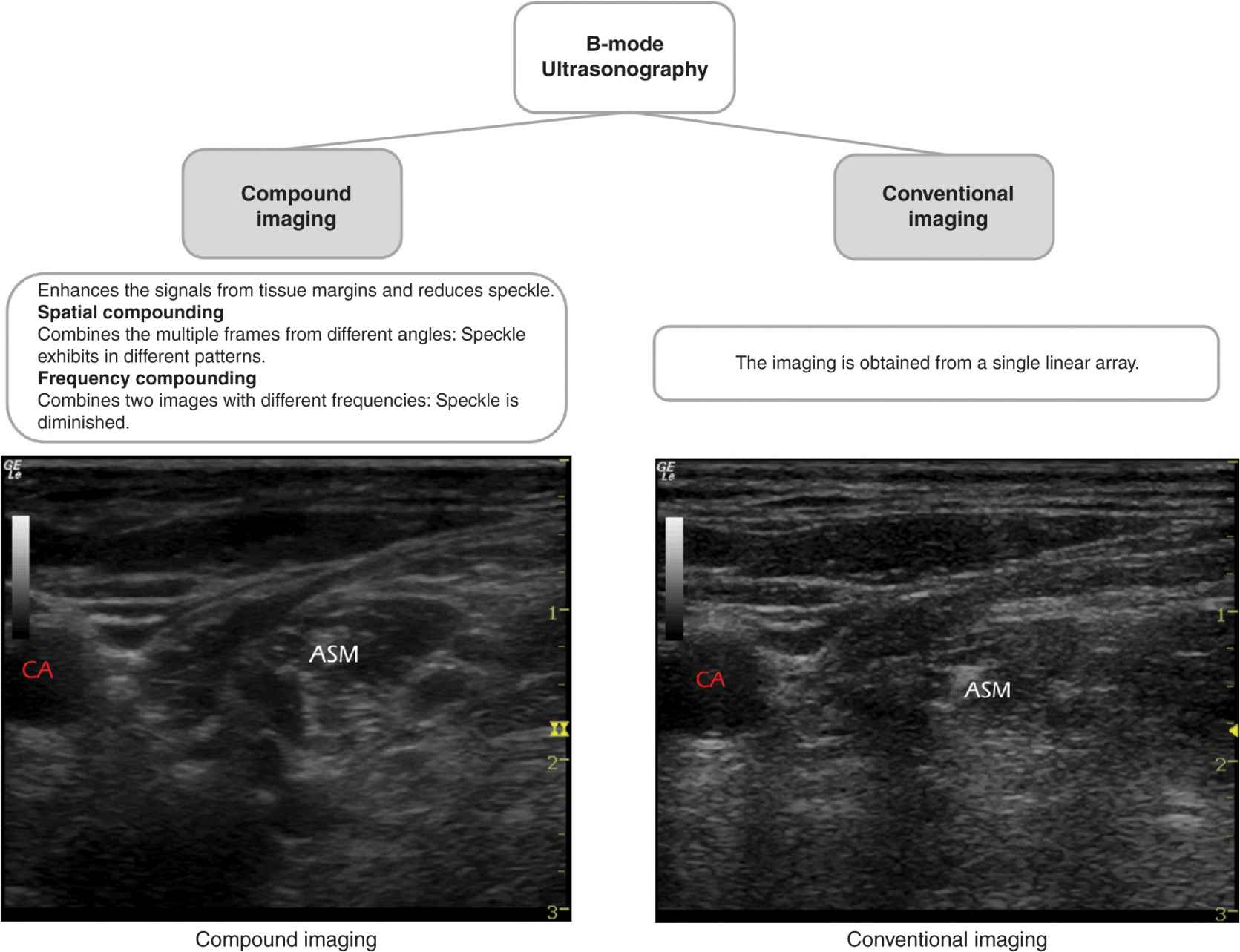 Optimizing an Ultrasound Image Anesthesia Key