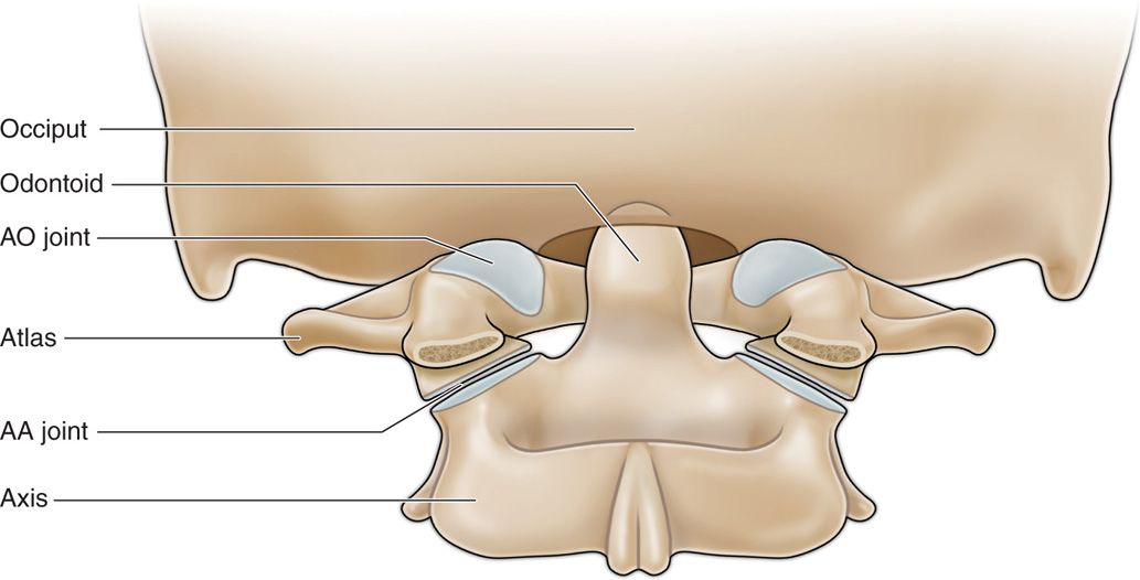 AtlantoOccipital Joint Injections Anesthesia Key