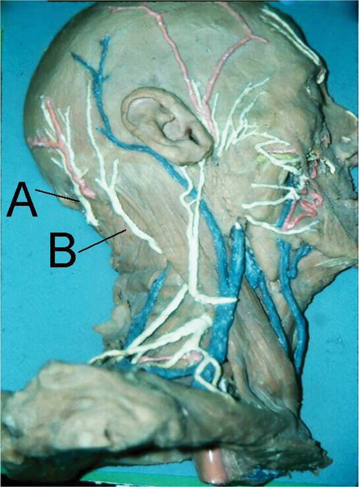 Occipital Nerve Blocks Anesthesia Key