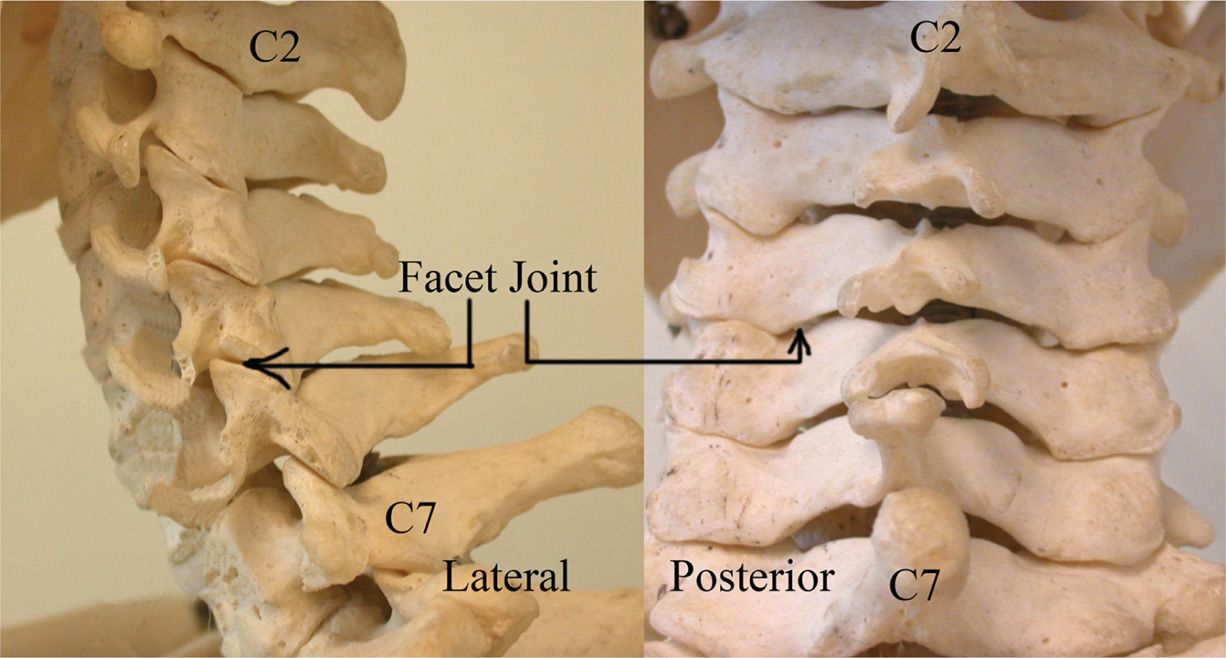 Facet Joint Interventions IntraArticular Injections, Medial Branch