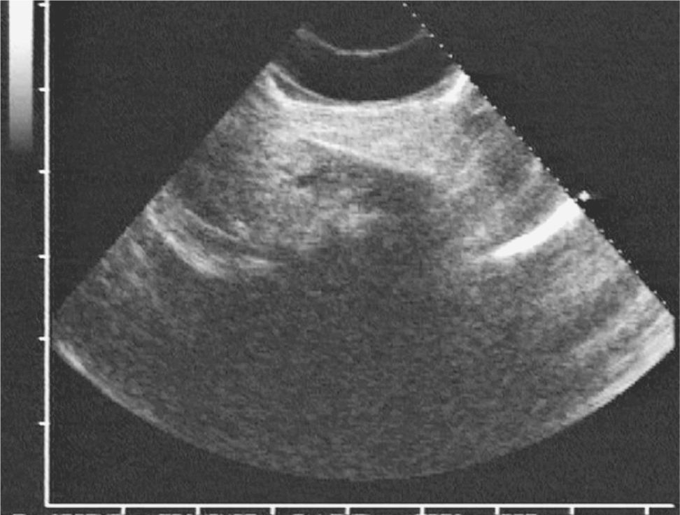 EVALUATING AND PREPARING WOUNDS Anesthesia Key