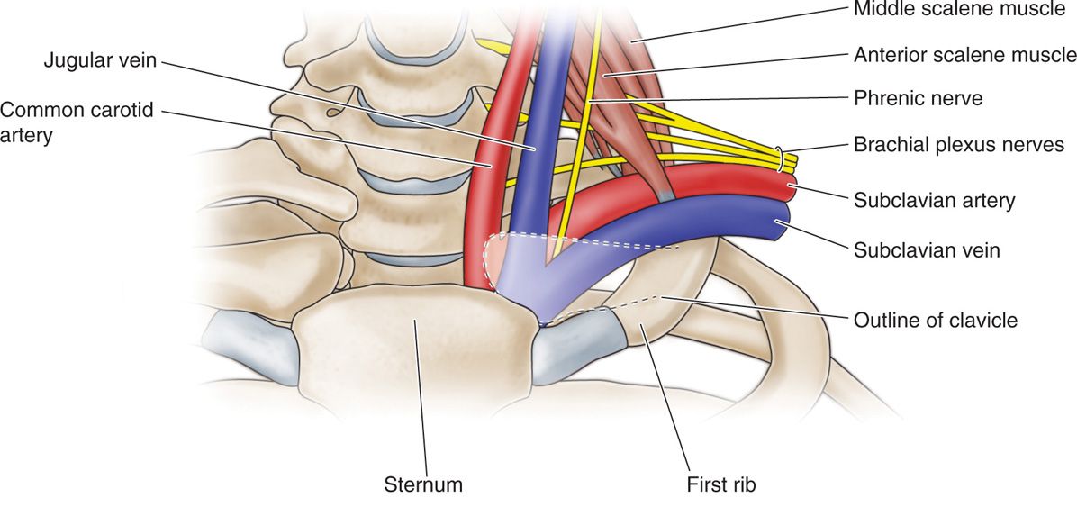Supraclavicular and Infraclavicular Nerve Blocks Anesthesia Key