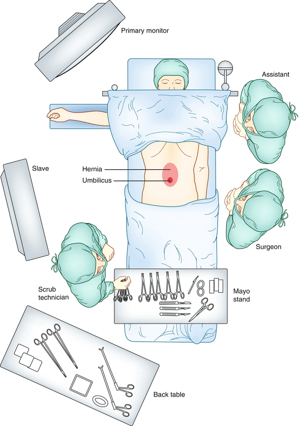 Laparoscopic Repair of Abdominal Wall Hernias Anesthesia Key