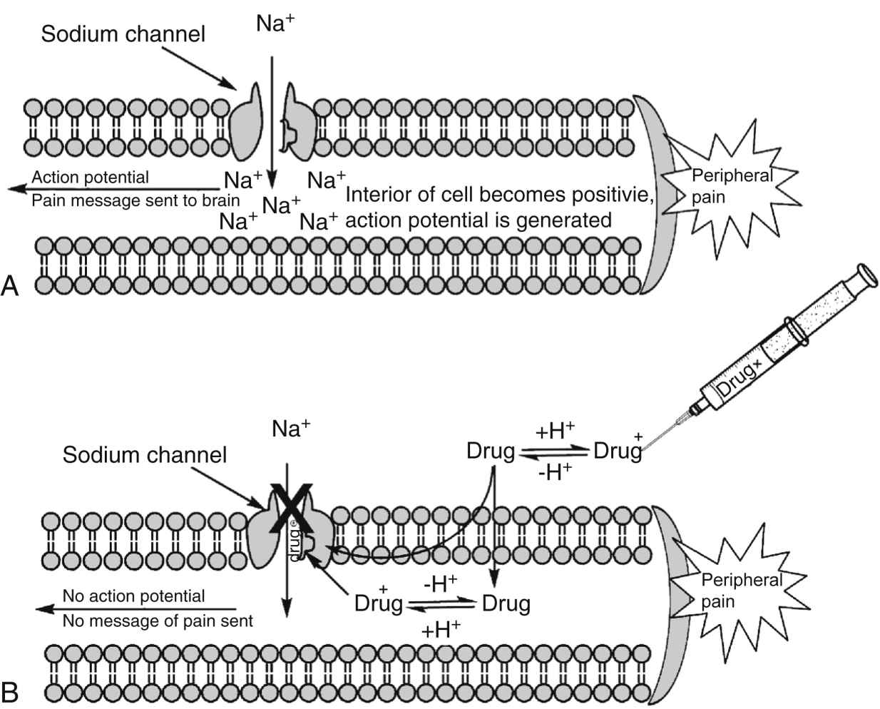 Anesthetic Agents Nerve Fibers