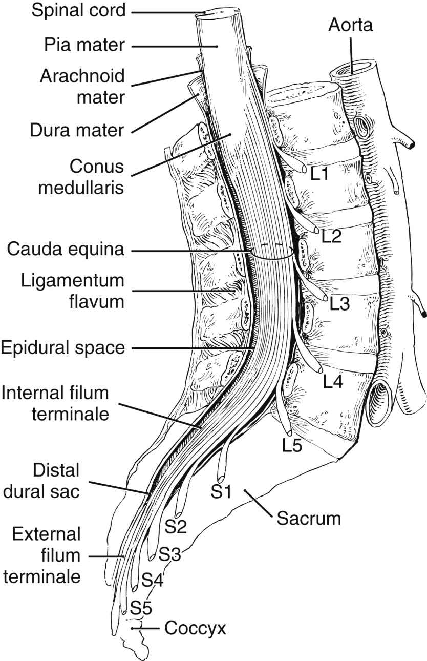 Regional Anesthesia Anesthesia Key