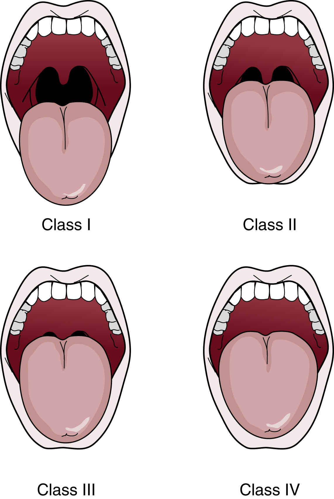 Airway Chart