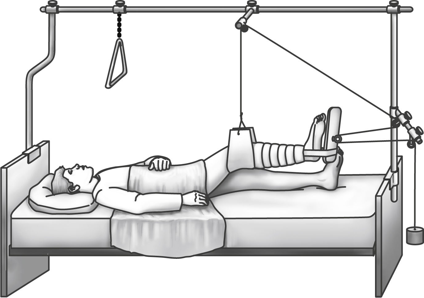 Care of the Orthopedic Surgical Patient Anesthesia Key