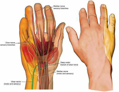Ultrasound-Guided Injection Technique for Ulnar Tunnel Syndrome ...
