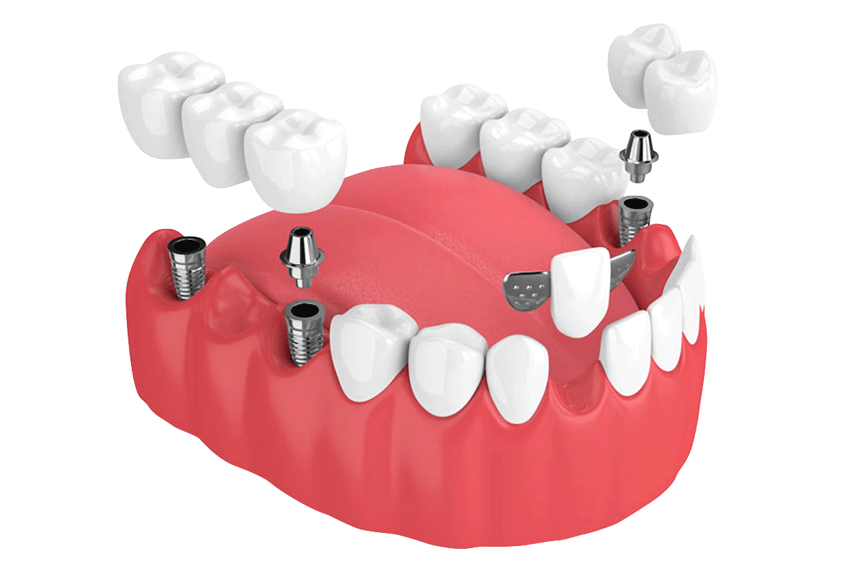 Prosthodontics Angle House