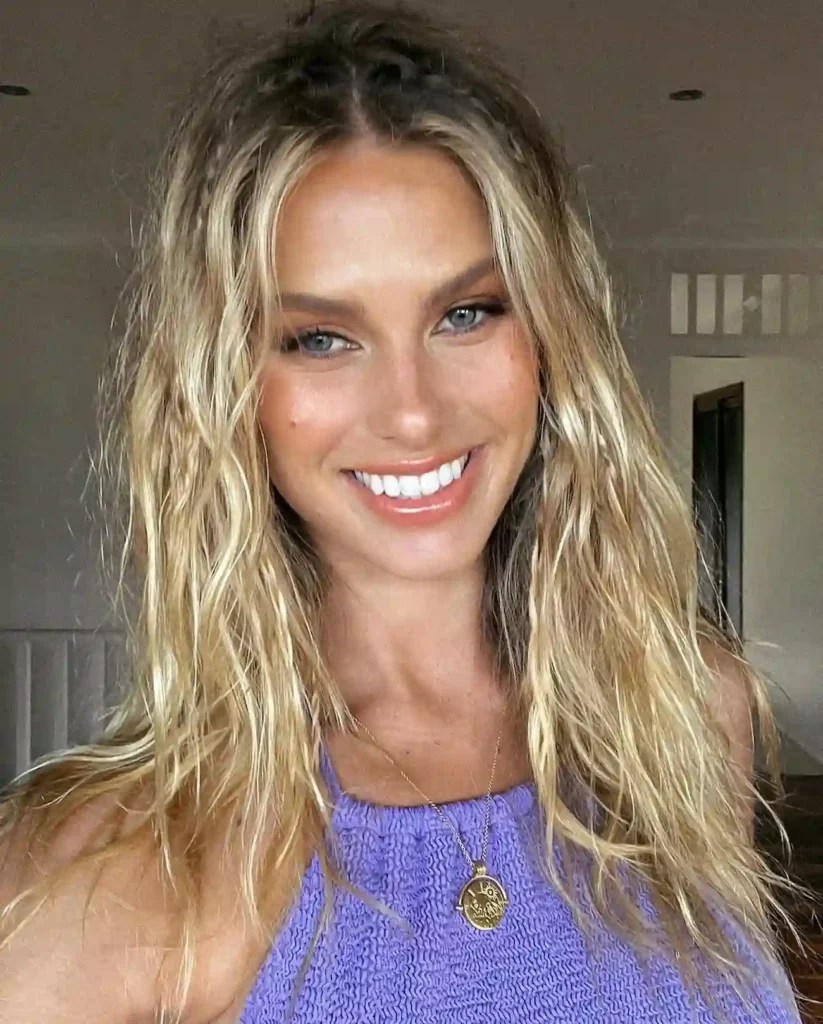 Natalie Roser Husband, Age, Biography, Bio, Boyfriend, Net Worth