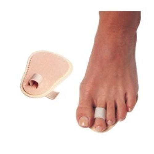 Plantar Plate Tear Ankle, Foot and Orthotic Centre