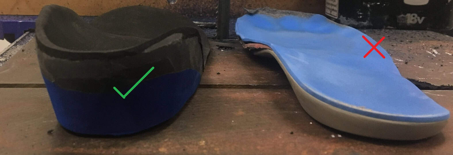 Accessory Navicular Syndrome Ankle, Foot and Orthotic Centre