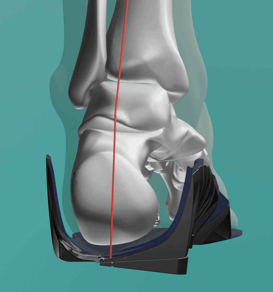 Heel Cup Orthotics atelieryuwa.ciao.jp