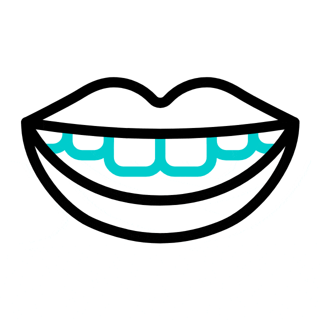 LightForce Custom Braces Anna Kids Dentistry