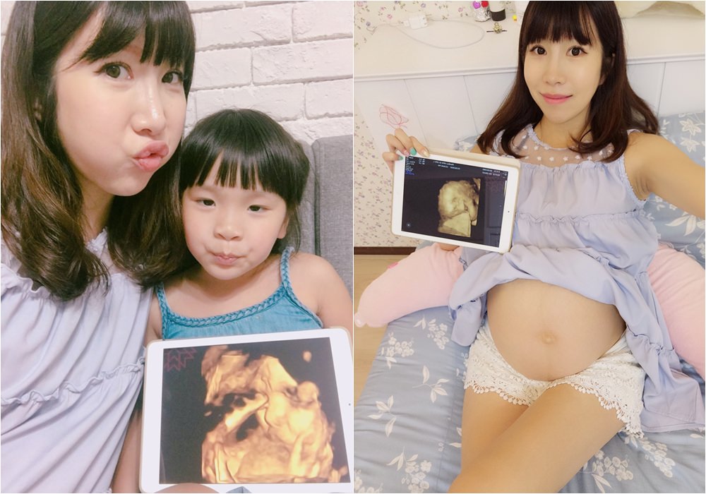 【懷孕】懷孕8~9個月 兩周一次產檢 ♥ 症狀/注意事項/飲食/待產包準備