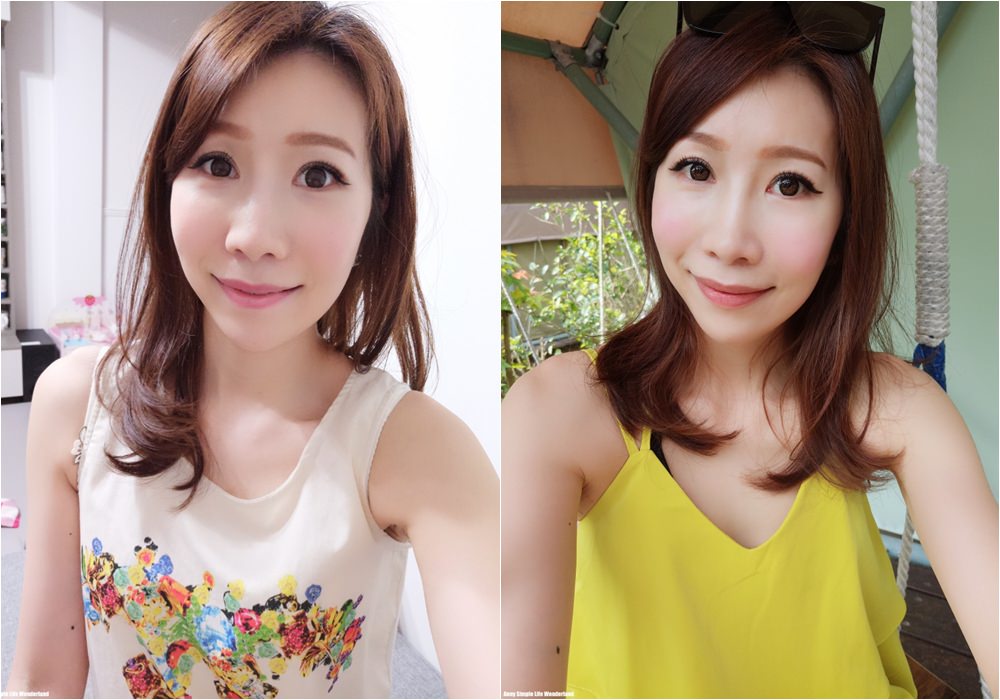 【分享】上立皮膚科診所 洢蓮絲液態拉皮 ♥ 讓我臉型更對稱更立體