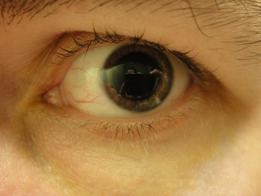 eye pressure, eye pressure question and answers Firmoo Answers