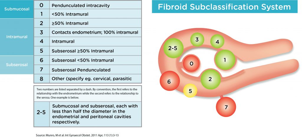 Fibroids Anthony Siow