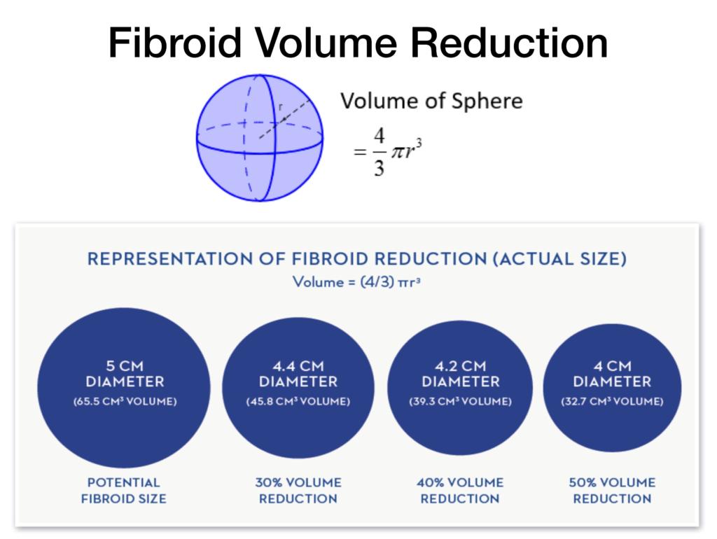 Fibroids - Anthony Siow