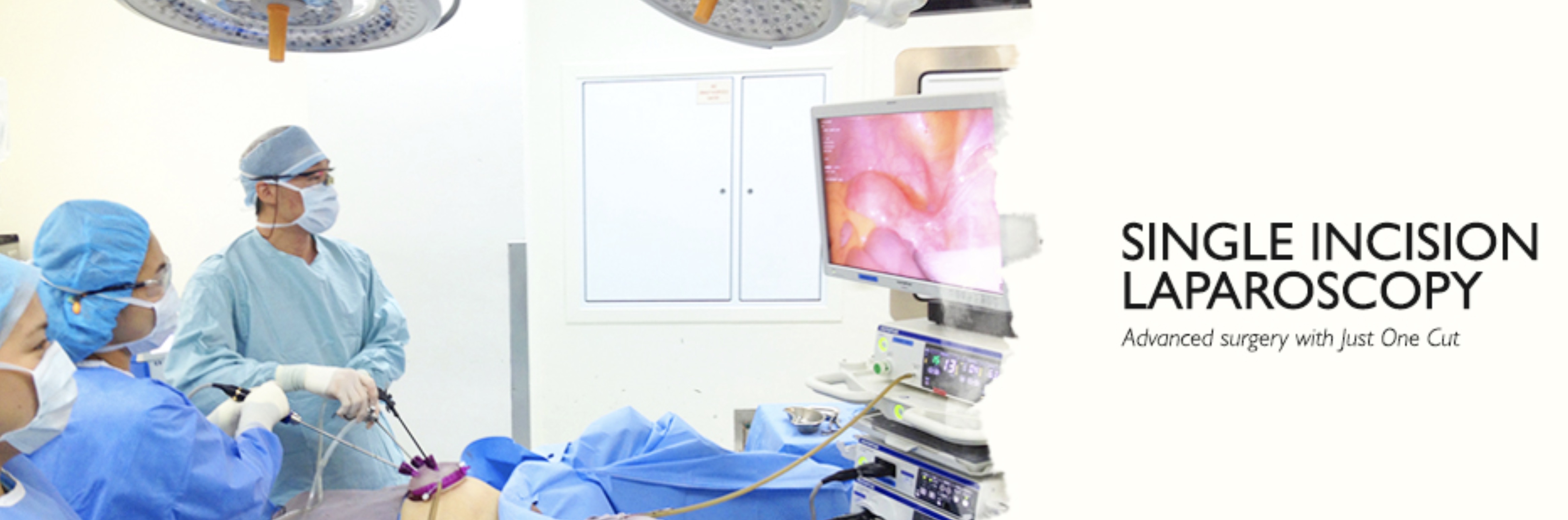 Single Incision Laparoscopy Anthony Siow