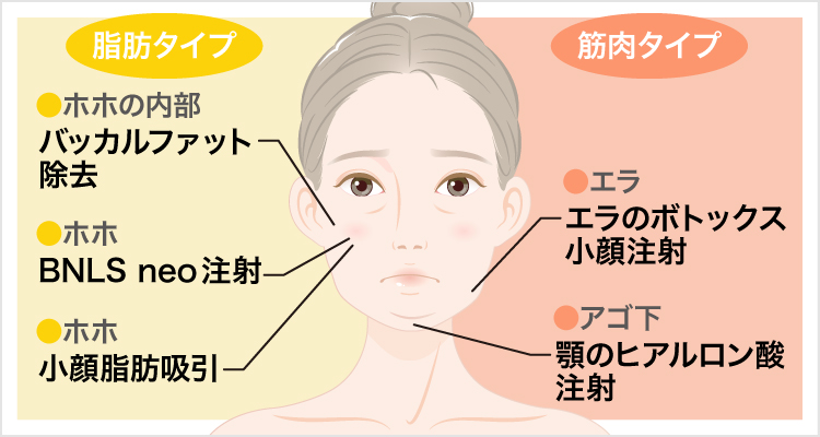 頬のお肉がなくなり彫が深くなりました！ | 愛知県名古屋岡崎豊田にある 小顔矯正 骨気（コルギ）のお店 お顔の肉を落とす効果的な小顔治療方法とは | 美容整形はTcb東京中央美容外科クリニック