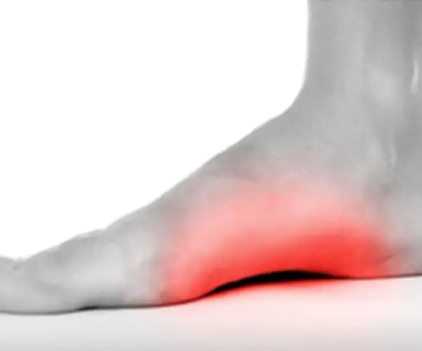 Arch Pain Doctor Thousand Oaks Apex Foot and Ankle