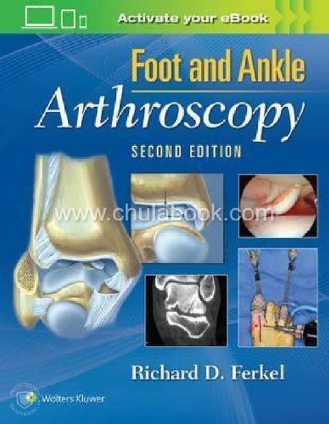 FOOT AND ANKLE ARTHROSCOPY (HC) ศูนย์หนังสือจุฬาฯ