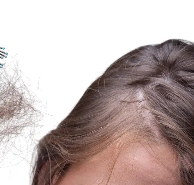 Best Hair Loss Treatment in Gurgaon Citrine Clinic