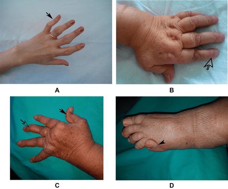 Can Black Mold Cause Cancer In Cats