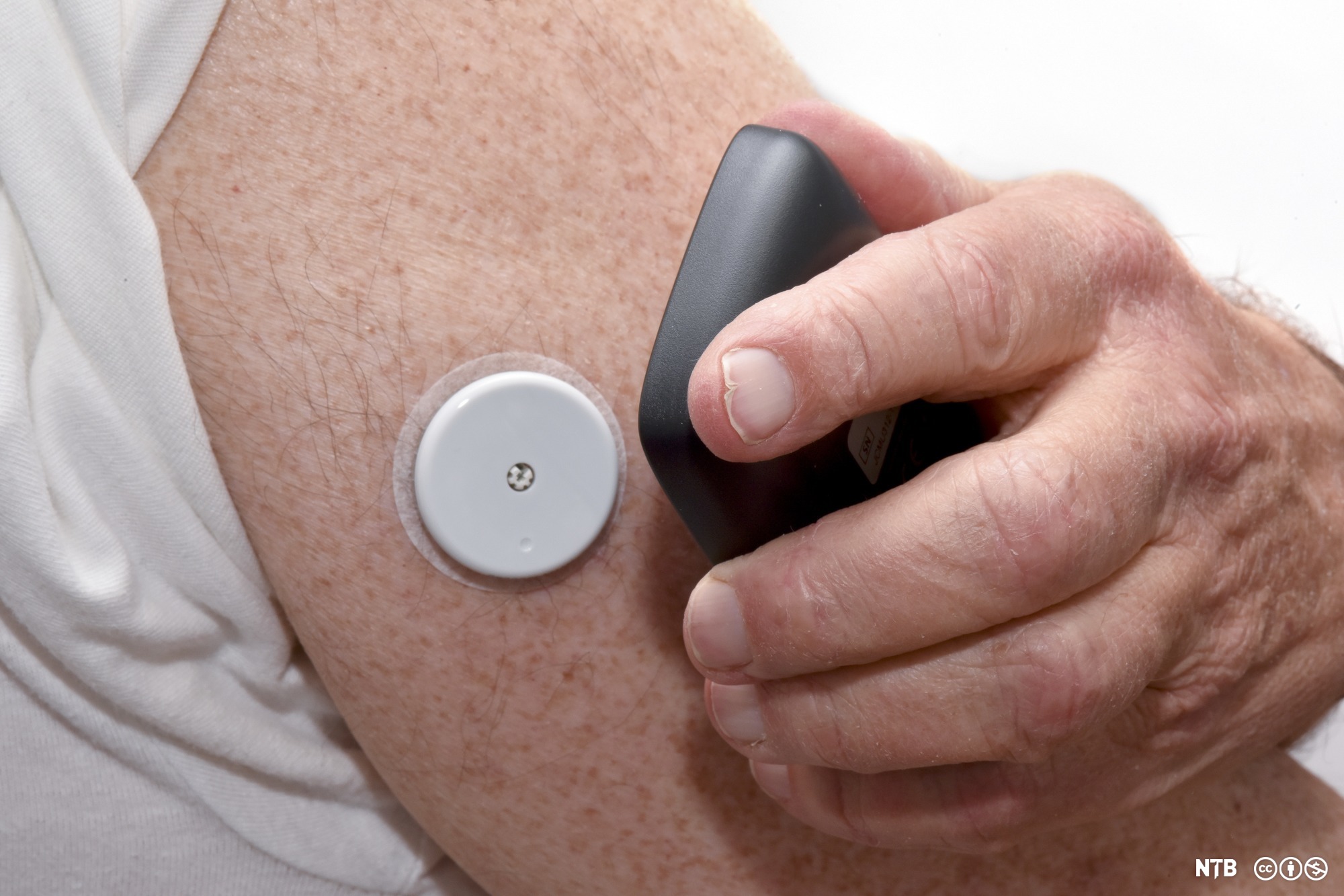 Sykepleie ved diabetes Helsefremmende arbeid NDLA
