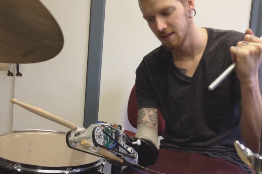Drummer Plays Jazz with Prosthetic Arm TIME